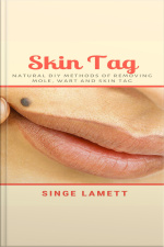 Skin Tag : Natural Diy Methods Of Removing Mole, Wart And Skin Tag