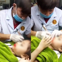 Can thiệp thẩm mĩ cho trẻ - Đâu là giới hạn?