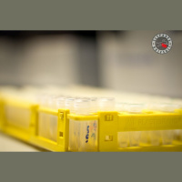 Slepkava brīvsolī. 2. Liktenīgais DNS