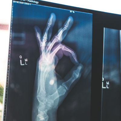 Balfül Podcast - Üzlet És Technológia Csak Lazán