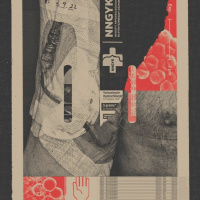 Direkt36 podcast #72 - Miért olyan rossz a kórházi fertőzések helyzete Magyarországon?