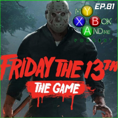 My Xbox And Me