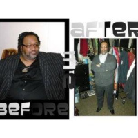 The Pros  Cons Of Weight Loss Surgery