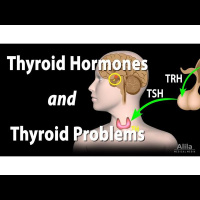 Is it your thyroid or hormones?