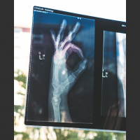 Diario de una Enfermera de Campaña en Tiempos de Coronavirus. Episodio V. ¡TODO ESTÁ BIEN!