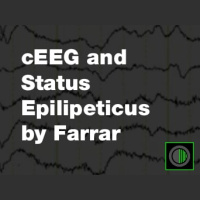 EEG and Status Epilepticus