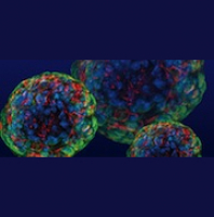 Rare Disease Horizons: The Hope of New Research and Technology, Part III: Stem Cells with Larry Goldstein, UCSD