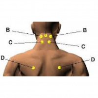 Pressure Points Prt 1- Dont Leave So Quickly