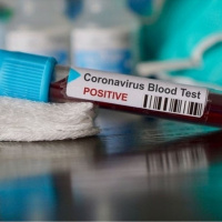 NutriMedical Report Thurs Feb 27th ’20 Hr3 SARS_DrOtt_MAGI_AntViralEMP