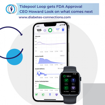 Diabetes Connections With Stacey Simms | Type 1 Diabetes |