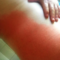 Burnt
