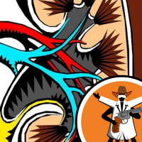 Kidney Transplants