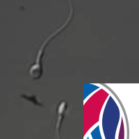 Human Sperm, Gut Bugs and Decomposition