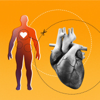 America Has an Organ Shortage. Could Paying Donors Close the Gap?