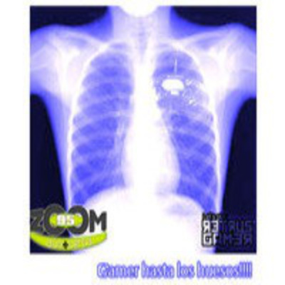 Podcast Retrus Gamer