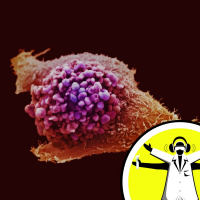 Catching Up with Cancer