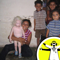 Getting Under Your Skin