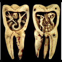 Tooth Worms and Tooth Pullers: Dentistry’s Rotten History