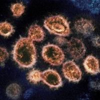 Virus Hunters Find Coronavirus Clues in Sewage