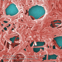 Whats Up With Water - August 26, 2019 Excerpt: Legionnaires Disease