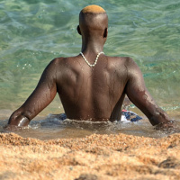 UV Exposure and the Risk of Cutaneous Melanoma in Skin of Color