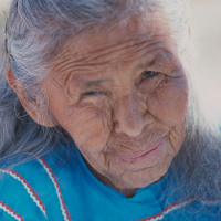 Barriers to Telehealth Programs and Dermatological Care for American Indian Communities