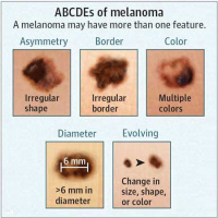 Association of Delays in Surgery for Melanoma With Insurance Type