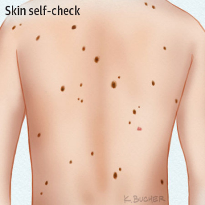 Jama Dermatology Author Interviews: Covering Research On The Skin, Its Diseases, And Their Treatment