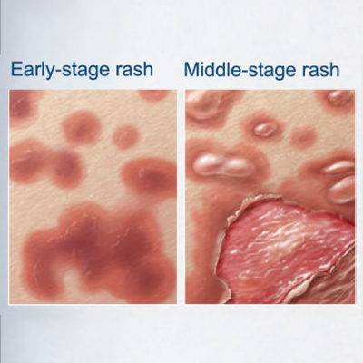 Jama Dermatology Author Interviews: Covering Research On The Skin, Its Diseases, And Their Treatment