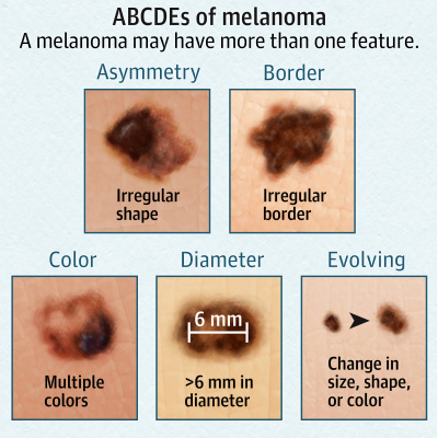 Jama Dermatology Author Interviews: Covering Research On The Skin, Its Diseases, And Their Treatment