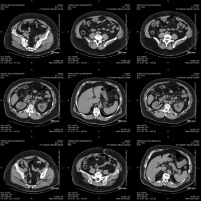 Jama Dermatology Author Interviews: Covering Research On The Skin, Its Diseases, And Their Treatment