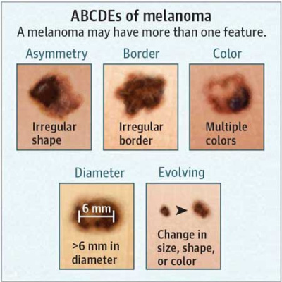 Jama Dermatology Author Interviews: Covering Research On The Skin, Its Diseases, And Their Treatment