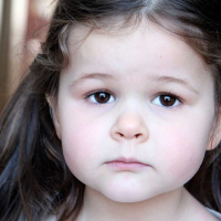 ¿Palidez en niños es señal de anemia?
