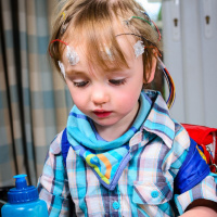 Epilepsia en niños