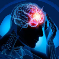 ¿Qué es la epilepsia?