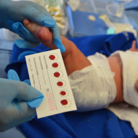 Tamiz metabólico neonatal y auditivo
