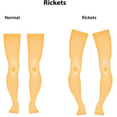 Pildoras De La Salud
