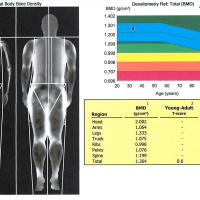 Ep. 89: Wrestling: Body Weight vs. Body Composition-Dr. Eric Twohey and Dr. Andrew Jagim