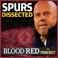 Liverpool suffer first defeat in 24 games at Spurs as youngsters set for Accrington Stanley chance