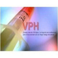 Vírus de Papiloma Humano VHP, con Nino Canún.