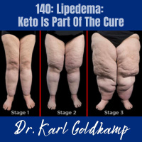 140: Lipedema: Keto Is Part Of The Cure