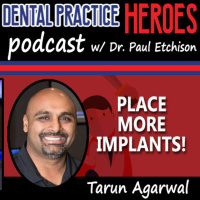 Tarun Agarwal - Place More Implants!