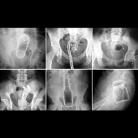 EMBARRASSING ER STORIES