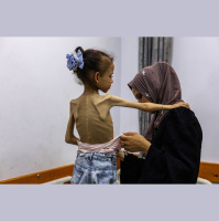 Gaza: Mtoto mwenye umri wa miaka 11 ana uzito wa kilo 9, kisa njaa!