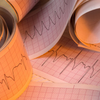 What amazing things have you witnessed while on placement? | Student Nursing Times Article from 2012