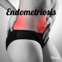 #162 Endometriosis
