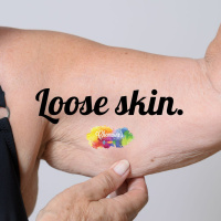 #300 Lets talk Loose Skin.