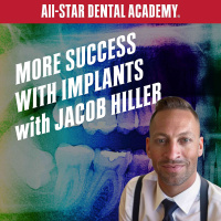More Success with Implants