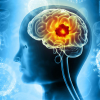 Its Brain Tumour Awareness week