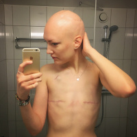 Med cancern som ständig följeslagare - Emma Skoglund